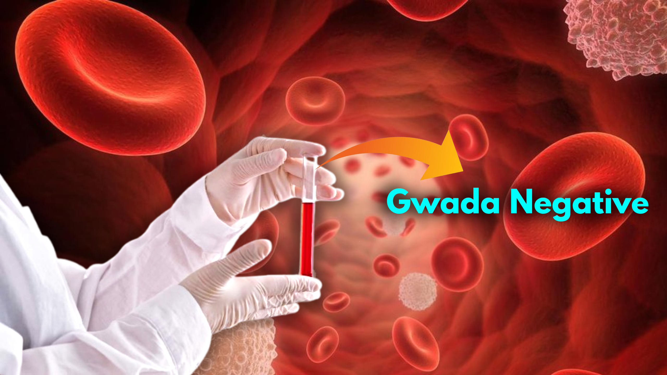 French scientists have discovered "Gwada negative," the world’s rarest blood type